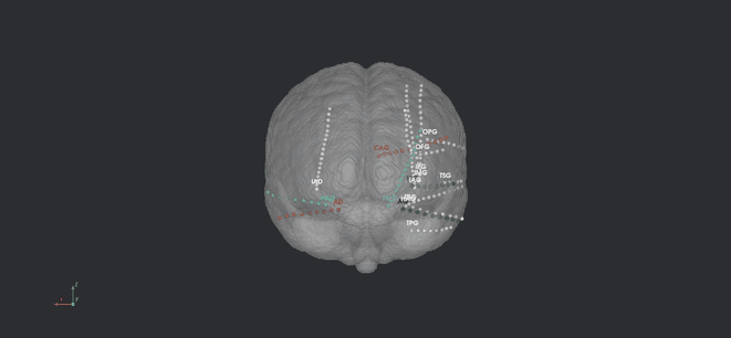 MNI atlas electrodes