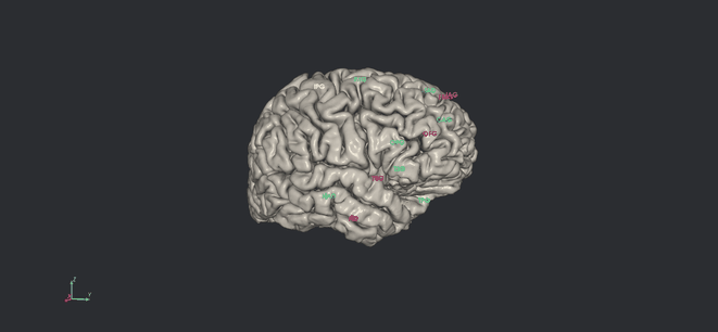 Pial surface rotation